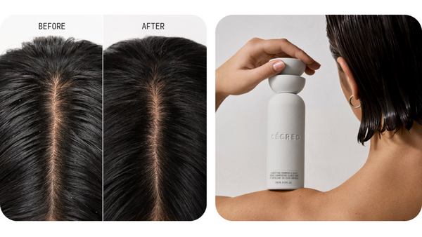 Photograph of model Before & After shows clean scalp after use of Scalp Scrub.